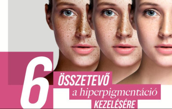6 összetevő a hiperpigmentáció kezelésére